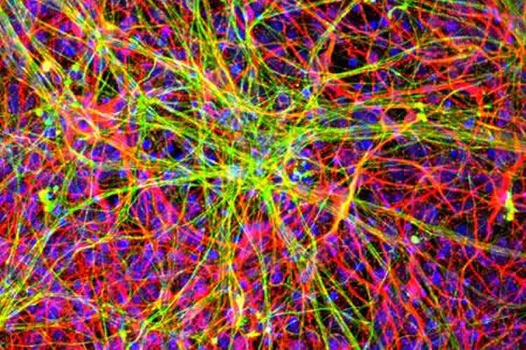 Image shows a motor neurons from iPSCs.