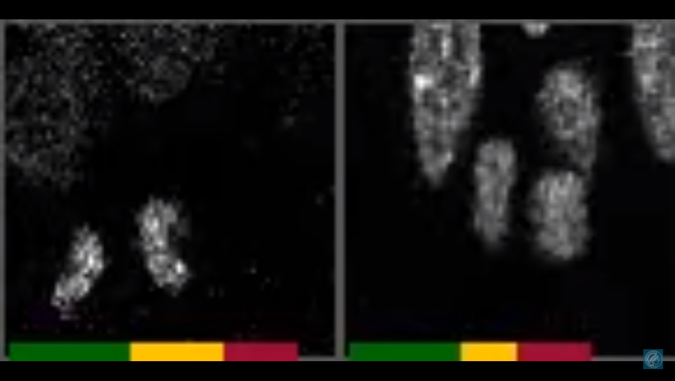 Image shows stem cells dividing.