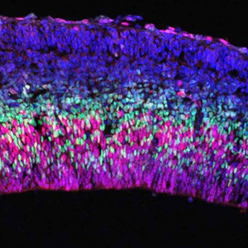 Image shows a brain slice.