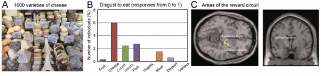 Image shows cheese and brain scans.