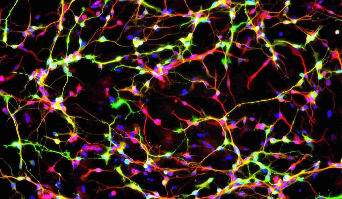 Image shows dopamine neurons.