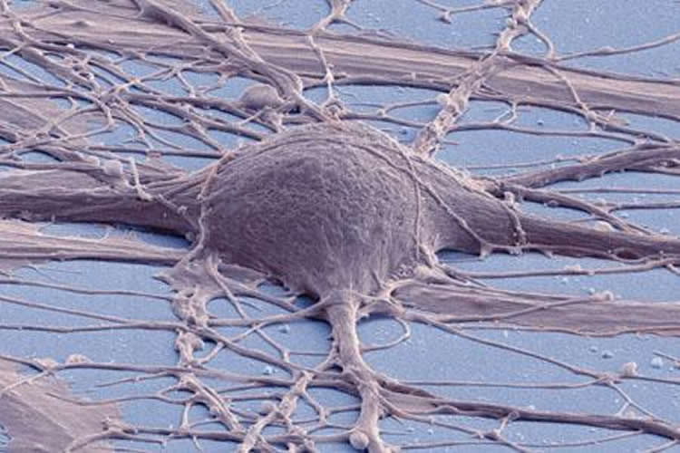 Image shows an iPSC derived neuron.