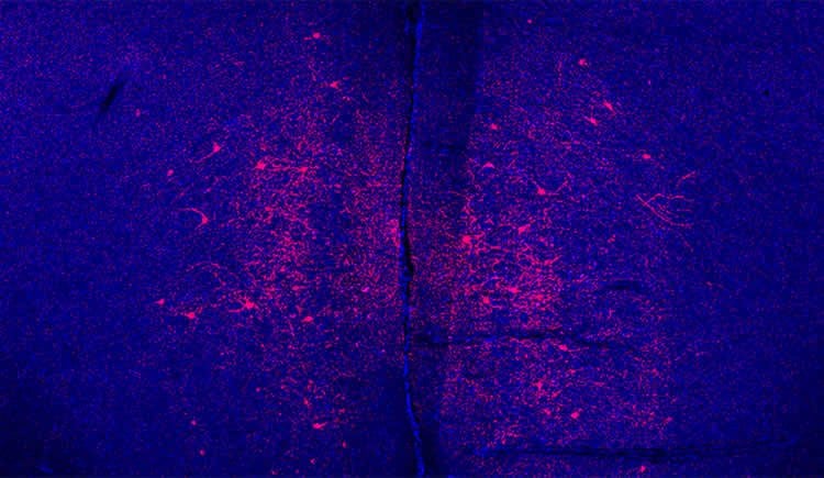 Image shows mouse neurons.