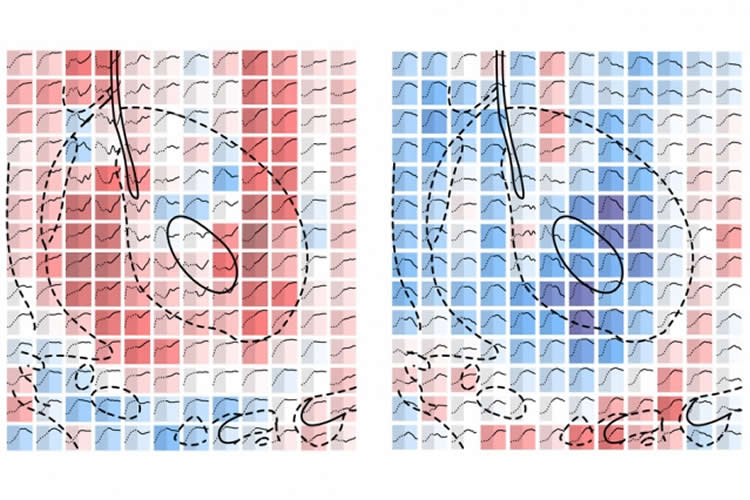 Image shows serotonin changes.