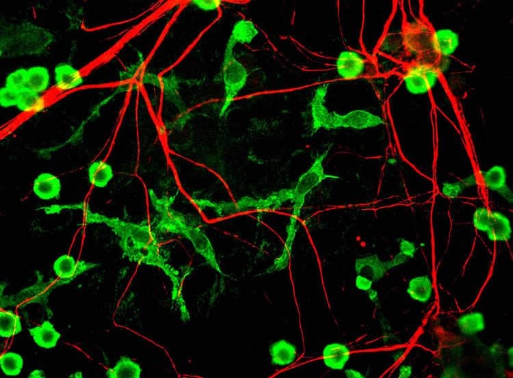 Image shows microglia.