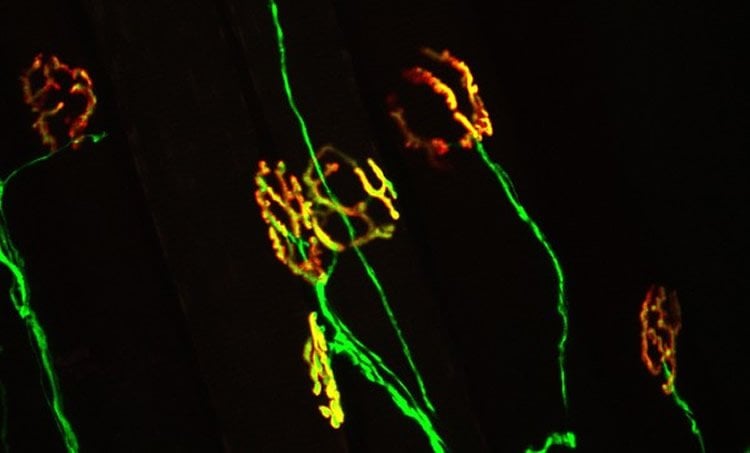 Image shows synapses.