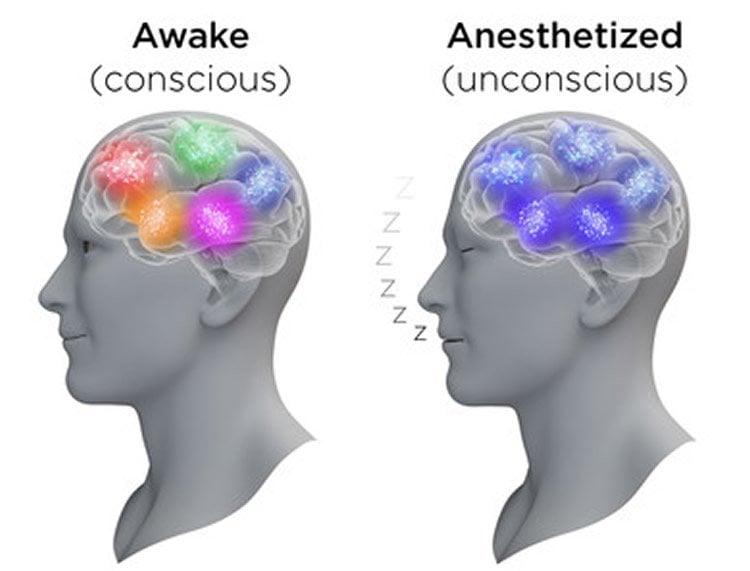 Anesthesia Brain Activity Neurosciencenews 