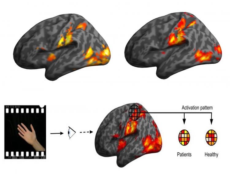 brain scans are shown.