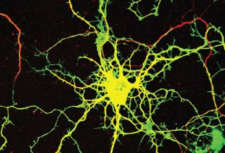 Image shows a neuron.