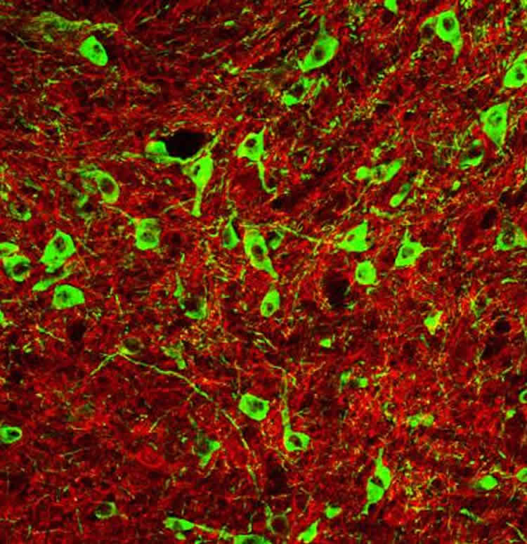 Image shows a dopamine neurons.