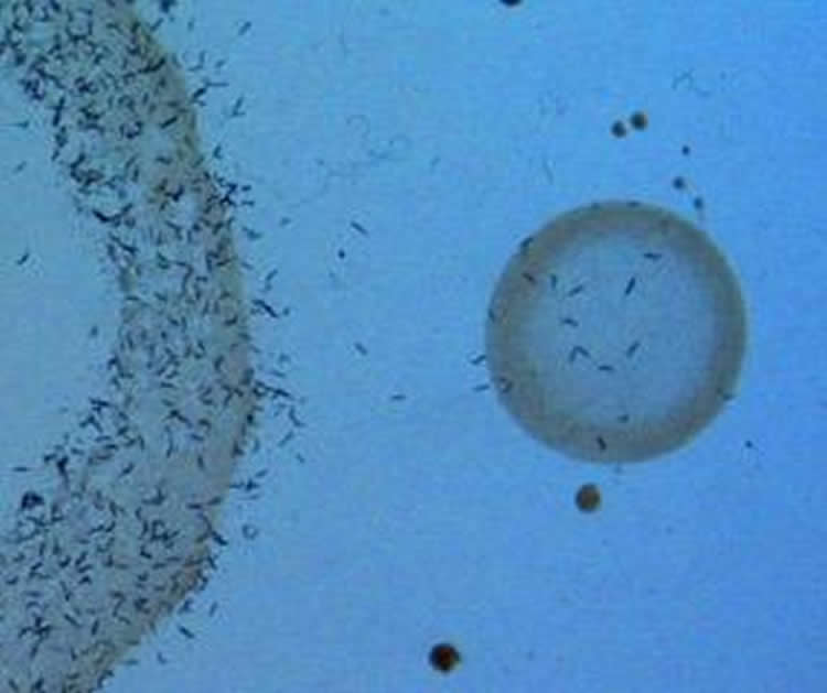 Image shows feeding worms.