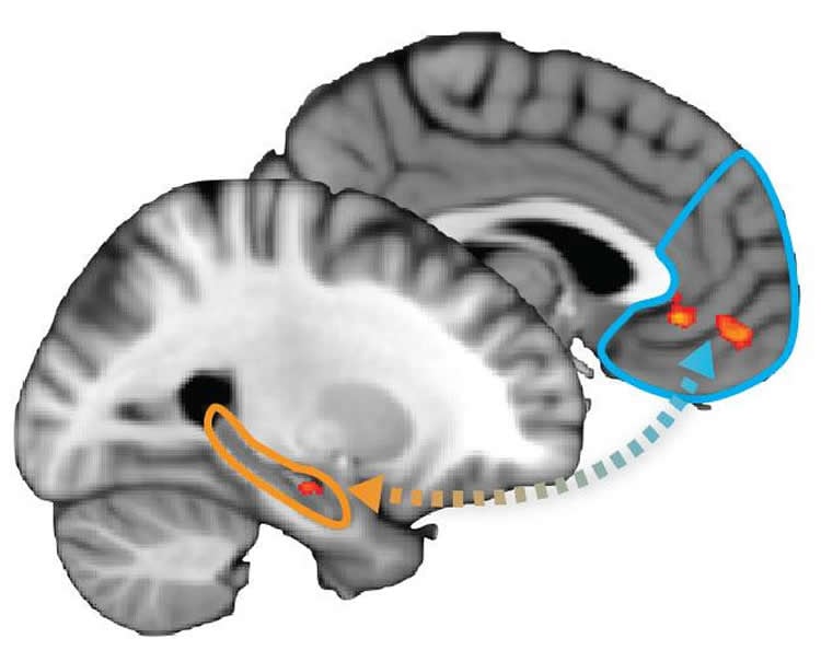 Image shows a split brain with the hippocampus and pfc highlighted.