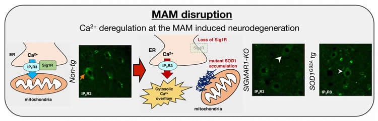 Image shows a schematic for MAM distribution in ALS.
