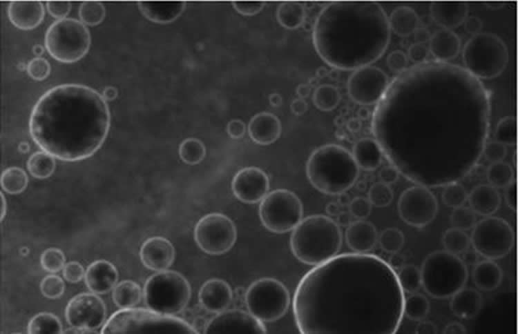 Image shows microbubbles.