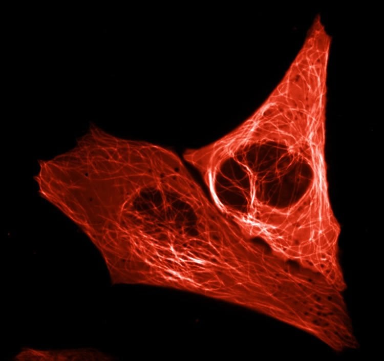Image shows a cell illuminated by mScarlet.
