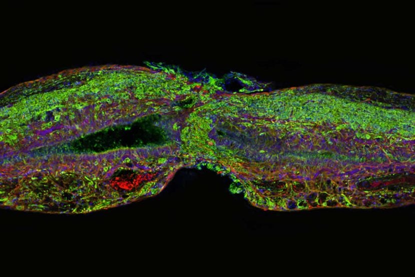 Image shows regenerated spinal cord cells.
