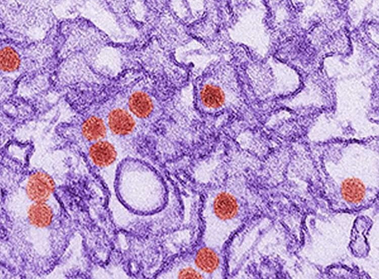 Image shows the zika virus.