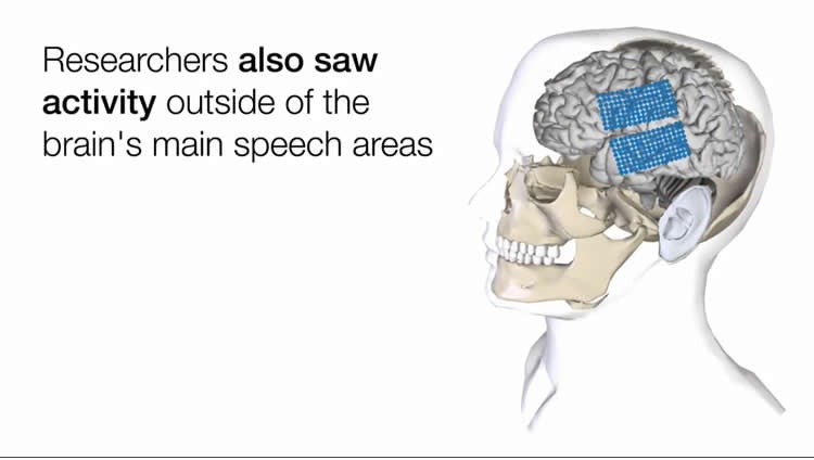 Image shows a head and brain.