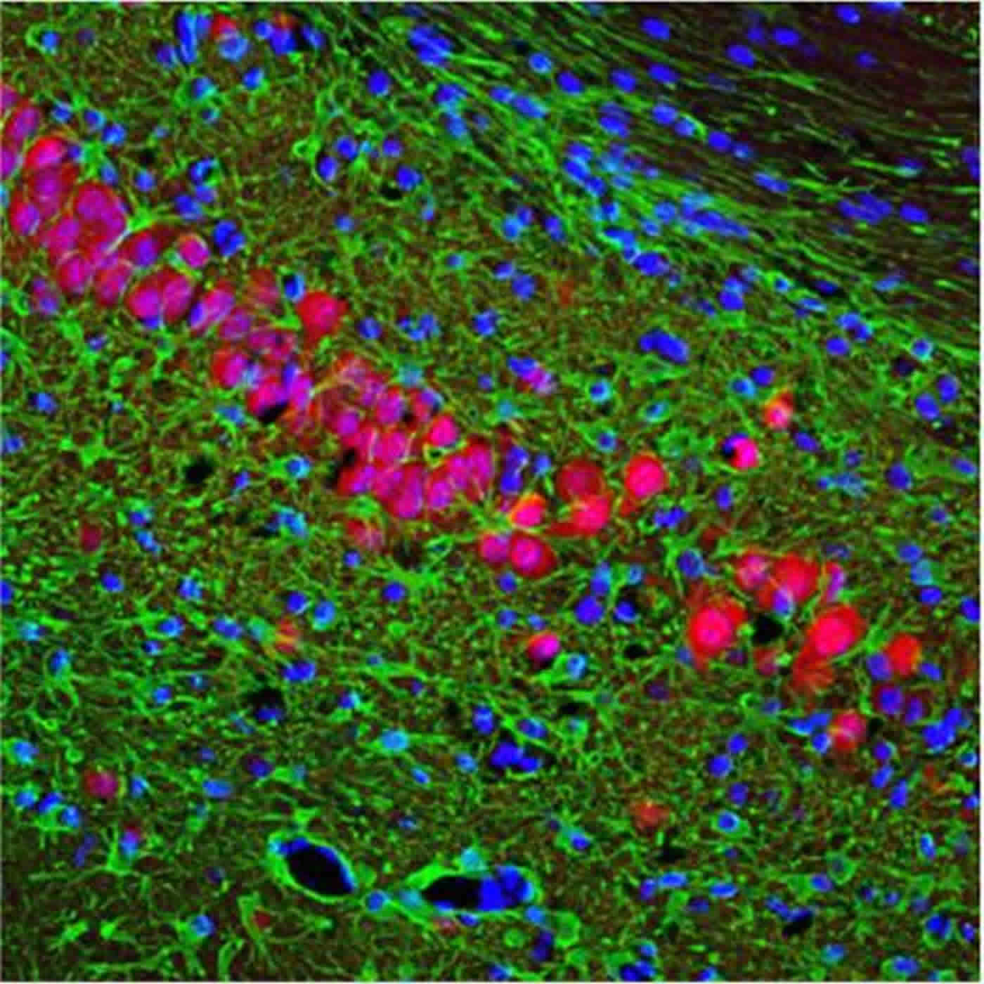 Image shows dying neurons in the hippocampus.