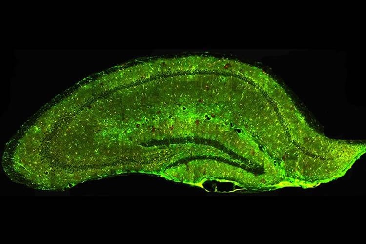 Image shows a mouse hippocampus.