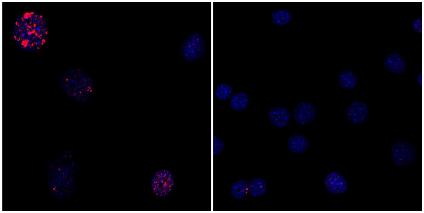 Image shows fibroblast cells.