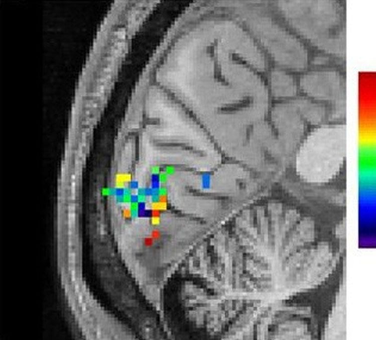 Image shows an fMRI brain scan with the visual cortex highlighted with colored dots.