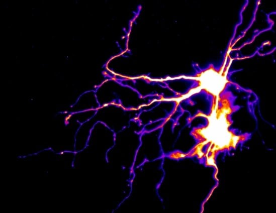 Image shows neurons and dendrites.