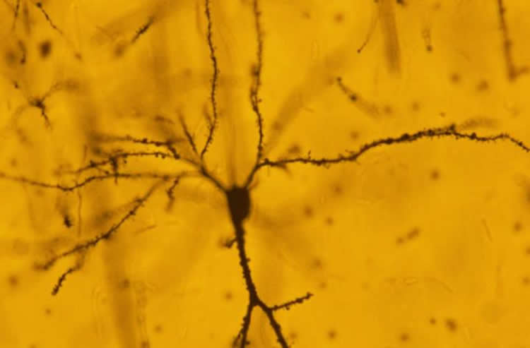 A neuron.