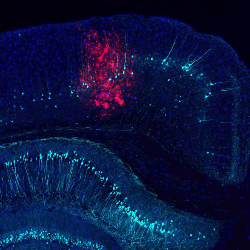 Image shows neurons in a mouse cortex.