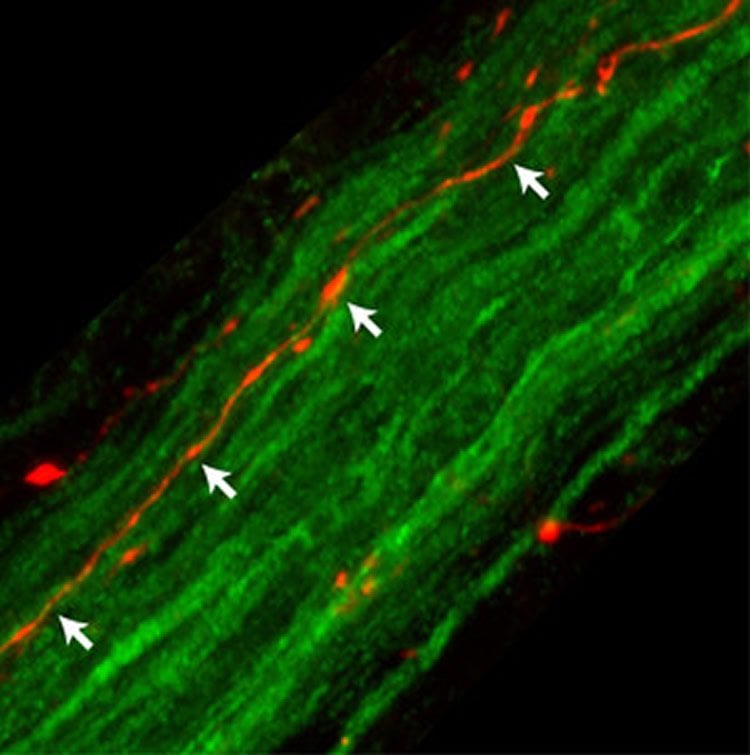 Image shows fibers of the rat vagus nerve.