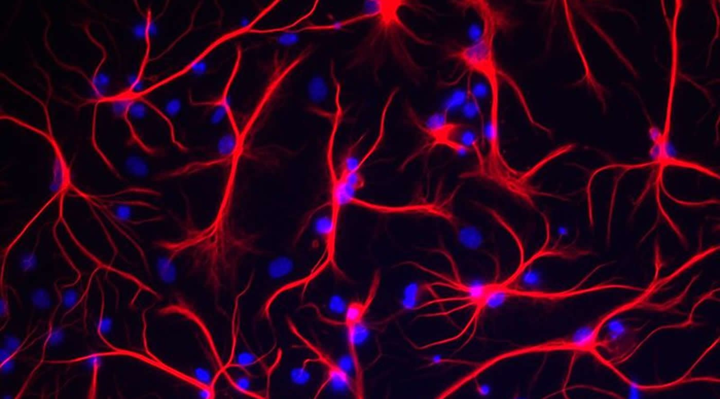 Image shows astrocytes in red.