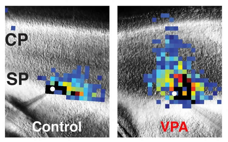 Image shows brain scans.