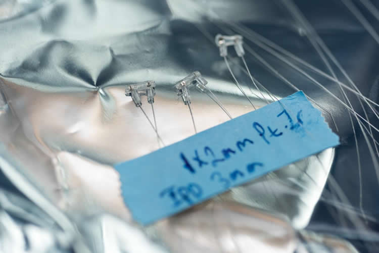 Image shows the electrodes.
