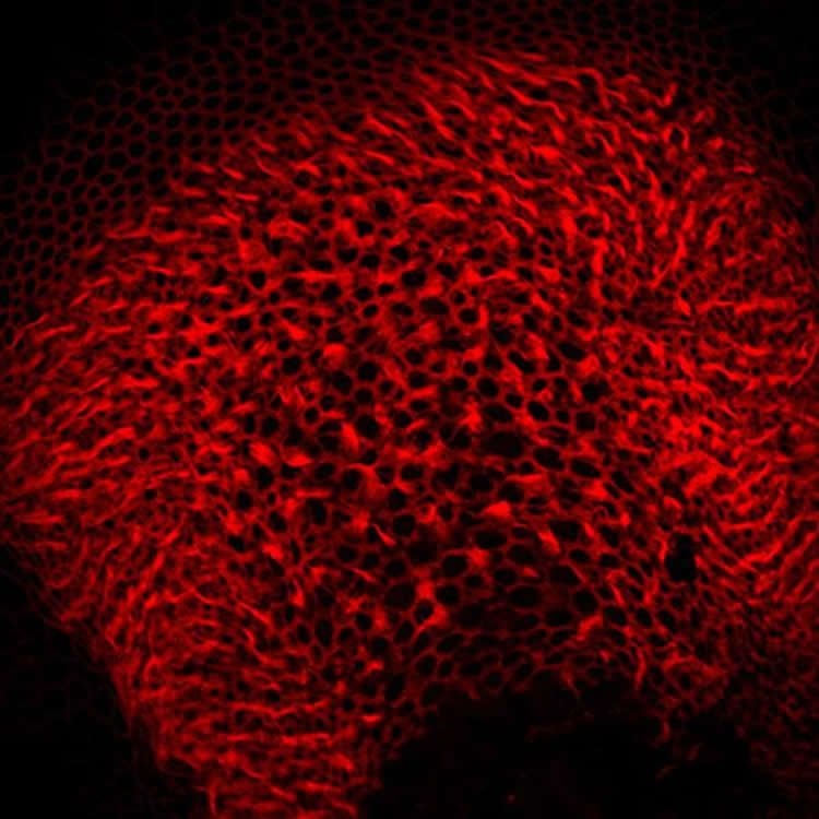 Image shows the hair cells in the inner ear of a mouse.
