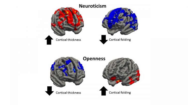 Image shows cortical thickness associated with neuroticism.