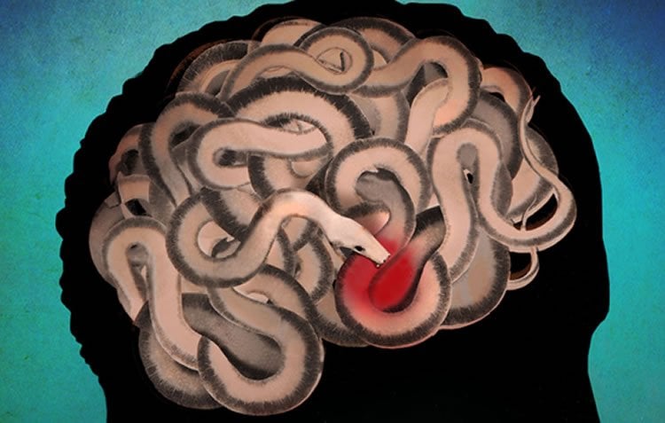 Image shows a brain made of snakes.