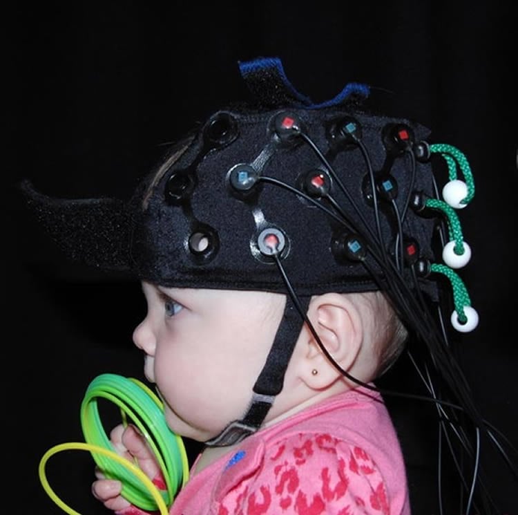 Image shows a baby in an EEG cap.