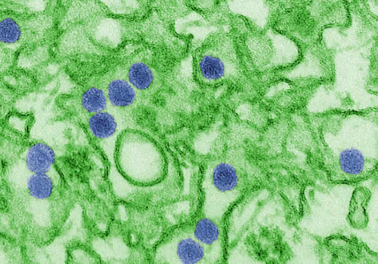 Image shows the zika virus.
