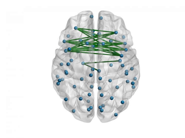 Image shows a brain with networked nodes.