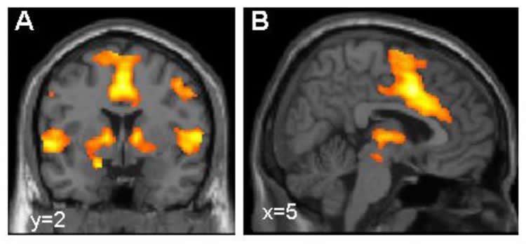 Image shows brain scans with the fear network highlighted in orange.