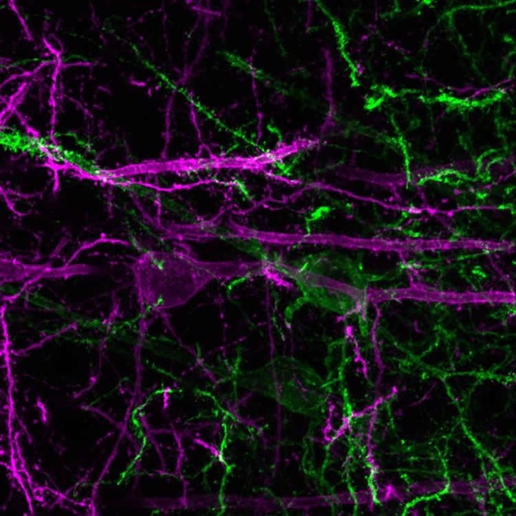 Image shows neurons.