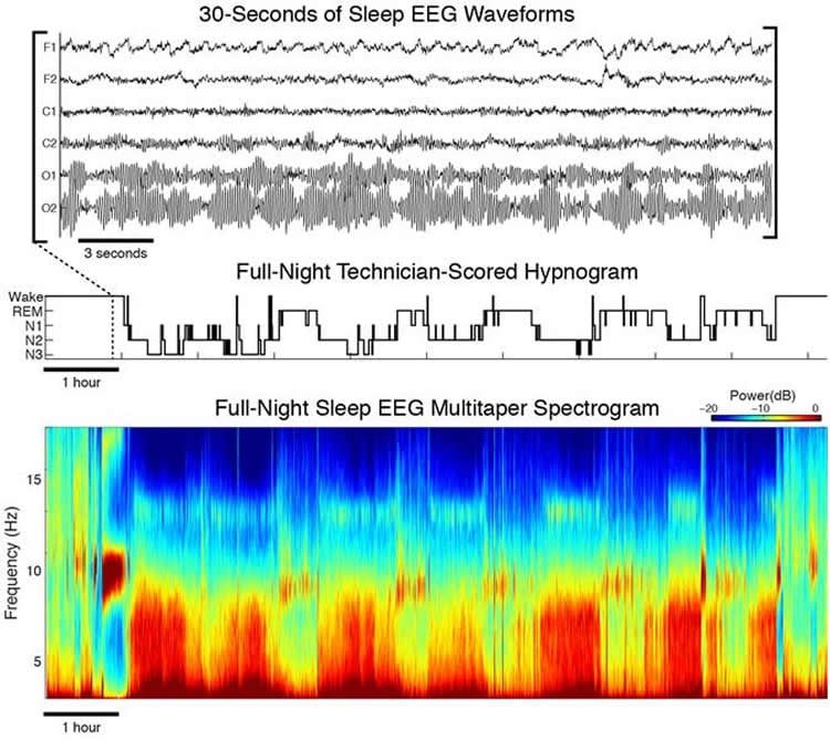 Image shows nthe EEG readouts.