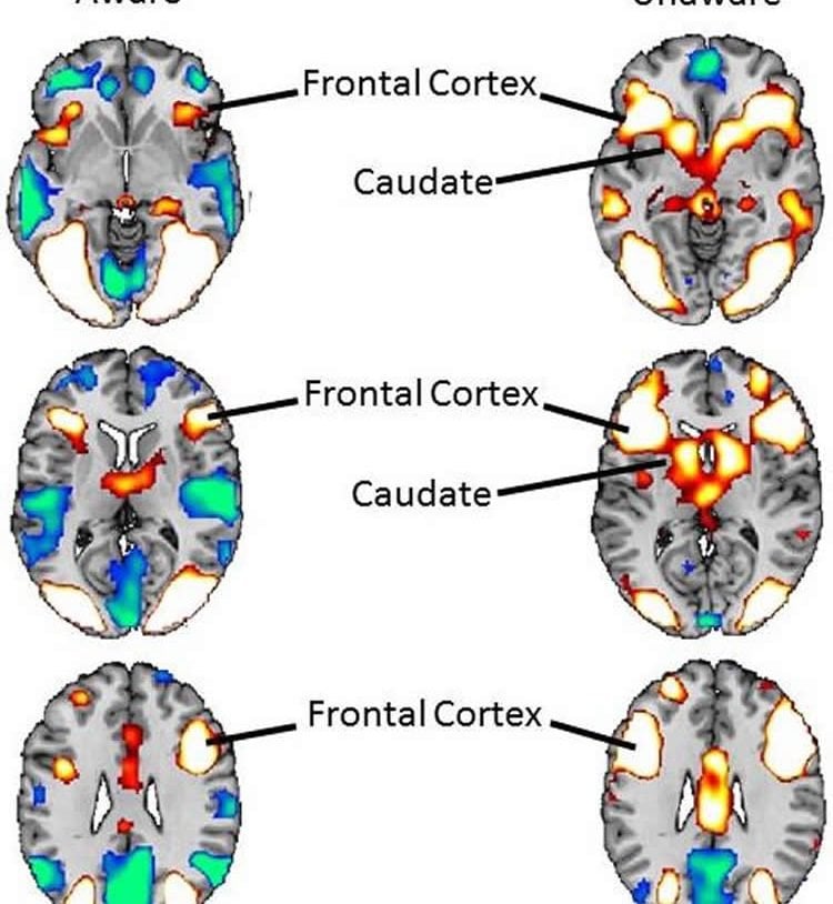 Image shows brain scans with activity from the stimuli highlighted.