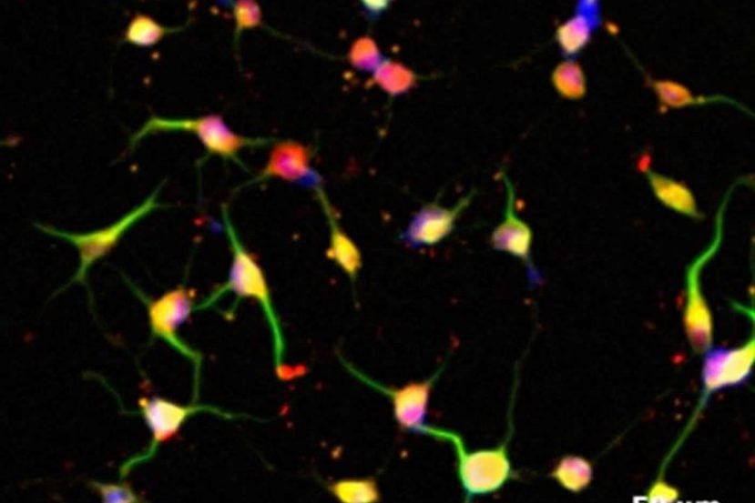 Image shows Keratinocyte-derive neural crest stem cells.