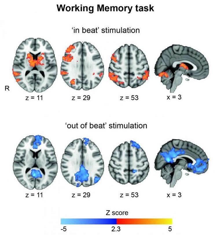 Image shows brain scans.