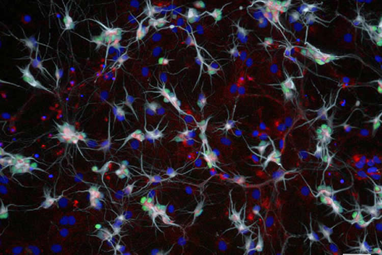 Image shows the SMN protein in motor neurons.