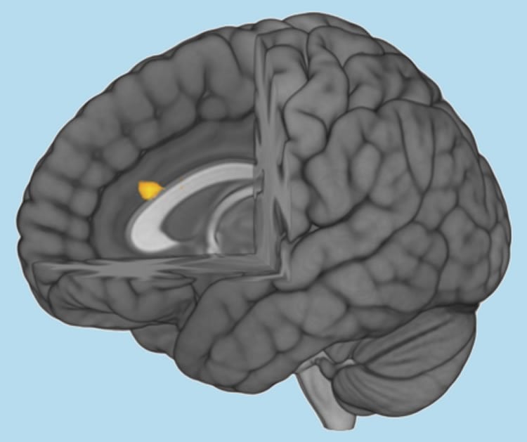 Image shows the location of the acc in the human brain.