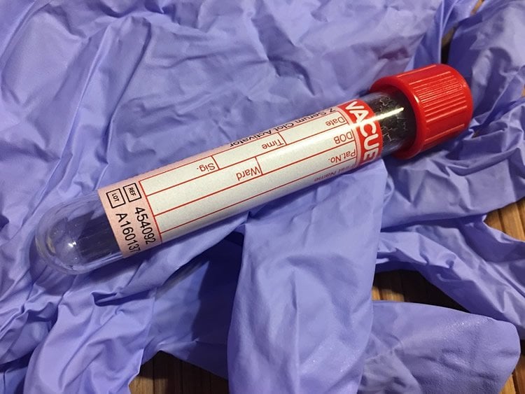 Image shows a blood sample tube.
