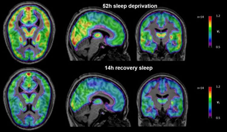 Image shows brain scans from the sleep deprivation study.