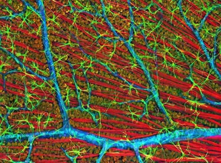 Image shows neurons in a mouse retina.
